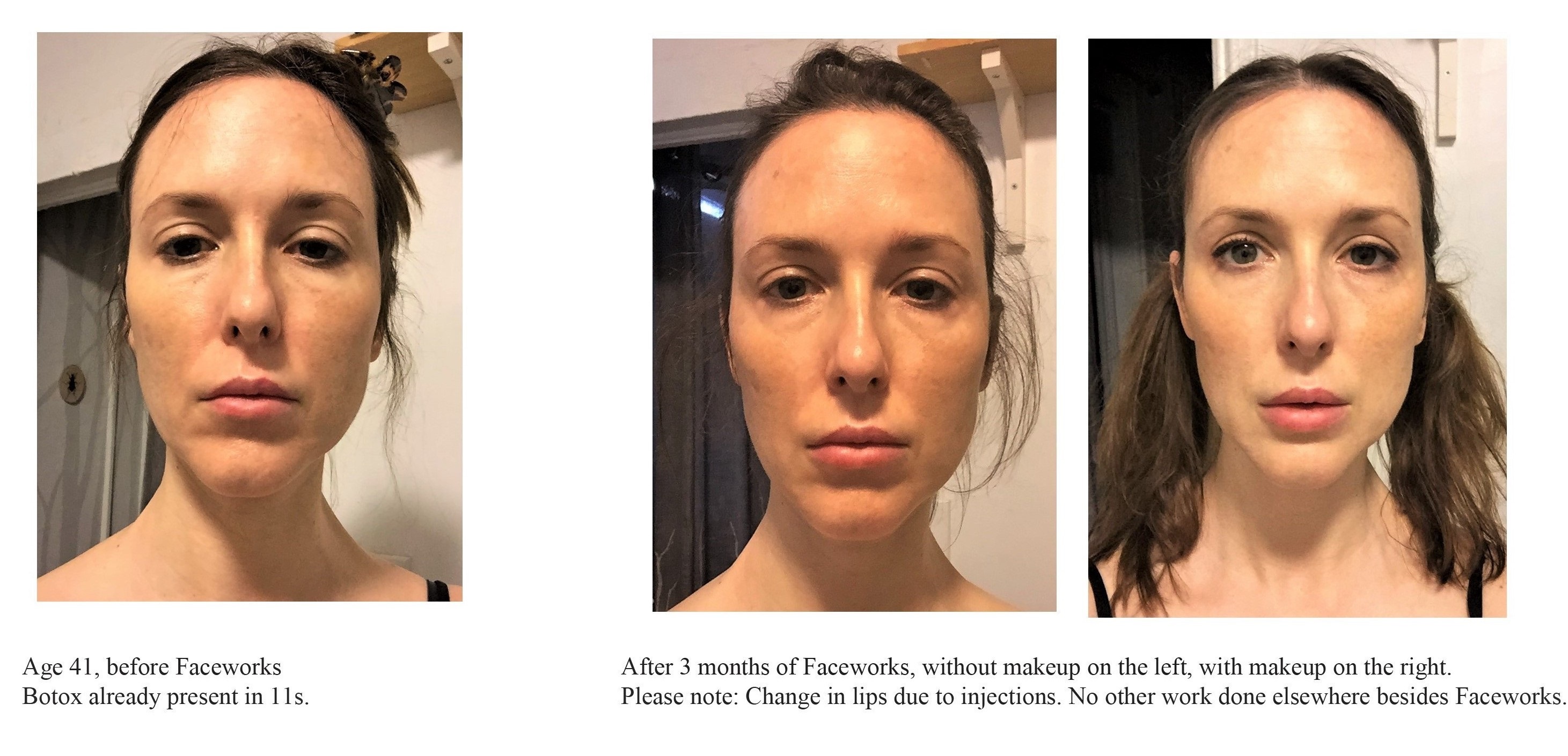 Kerry, USA Before & After Faceworks face exercises.