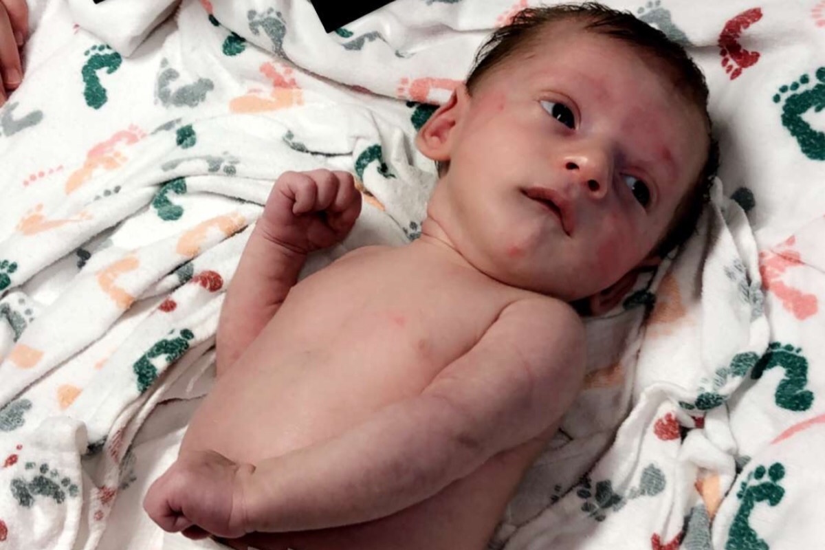 Help for Baby Atlas, Colleen and Jeff Crowley We Care