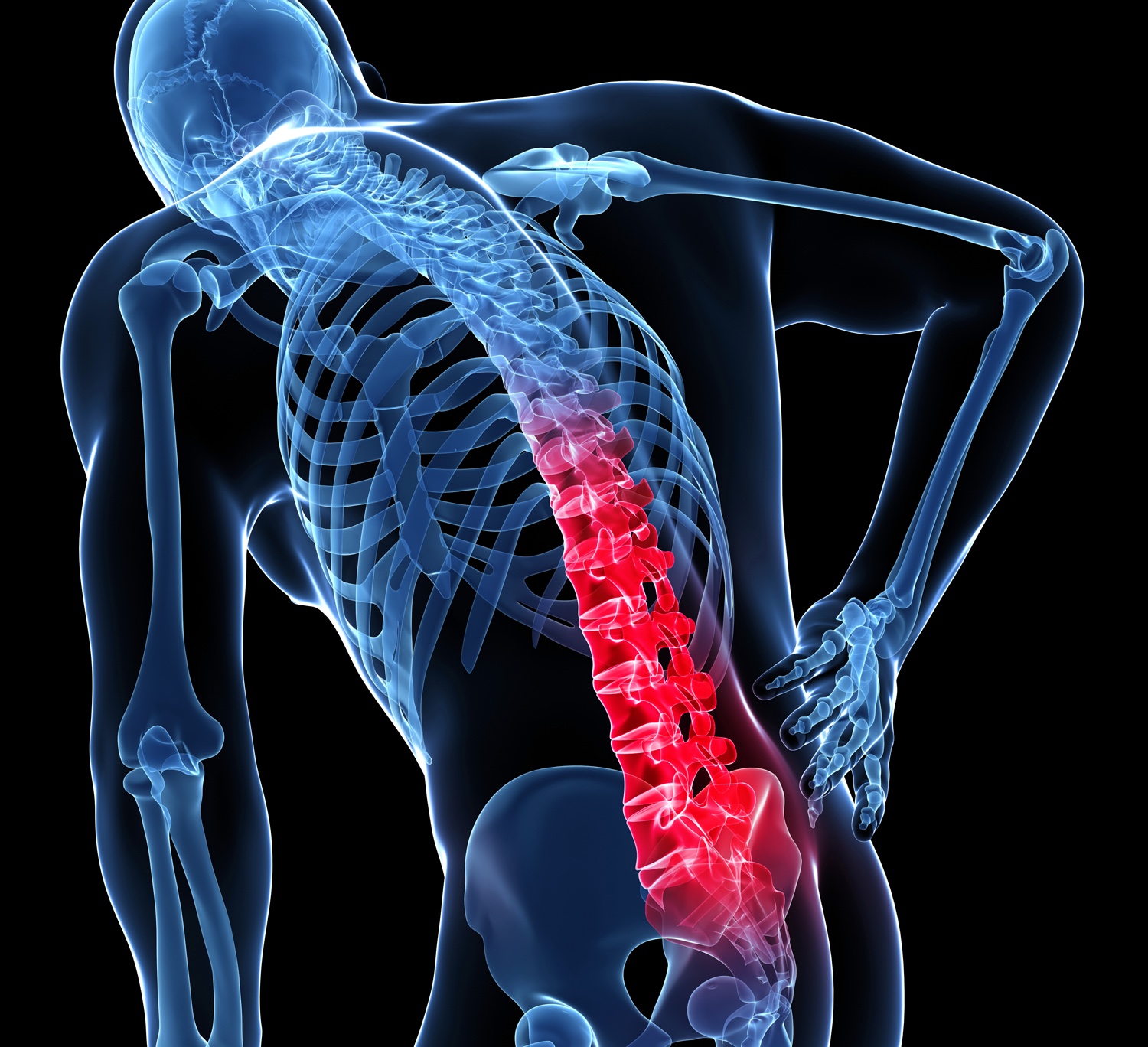 Persistent Low Back Pain | Spinemobility
