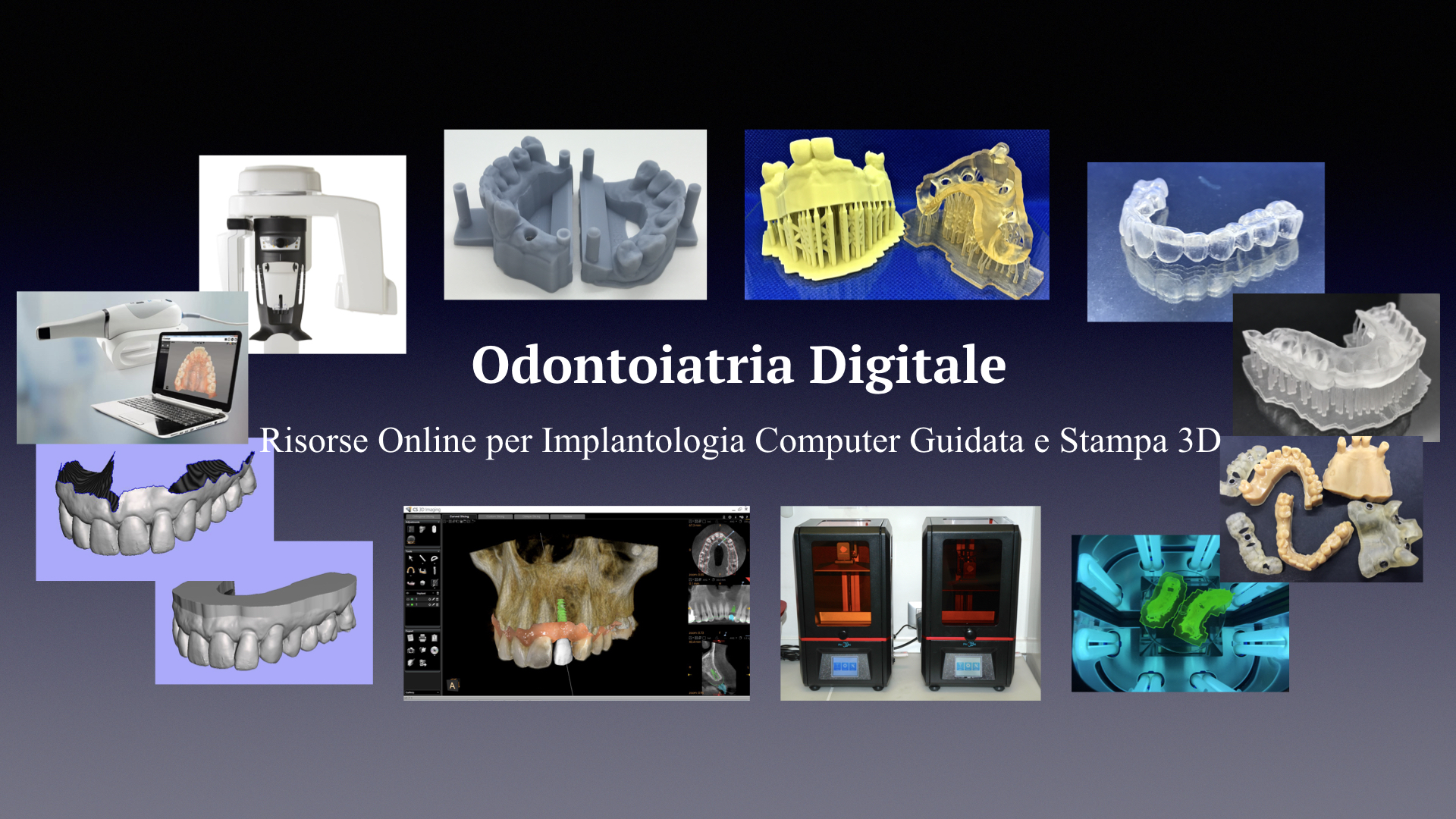 Odontoiatria Digitale strumenti implantologia computer guidata stampa 3D